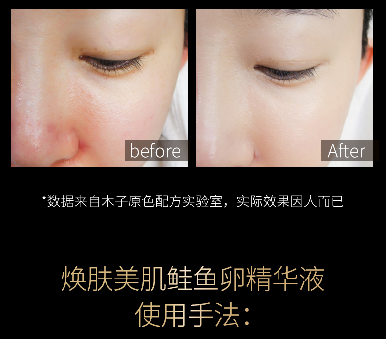 鲑鱼精华液_09